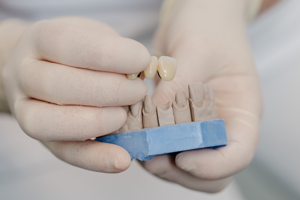 zahnarzt-holzkirchen- porthetik zahnarzt-holzkirchen- porthetik