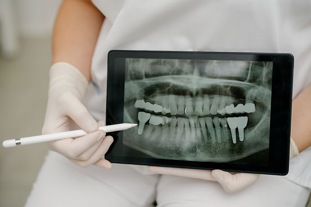 zahnarzt-holzkirchen-implantologie zahnarzt-holzkirchen- implantologie