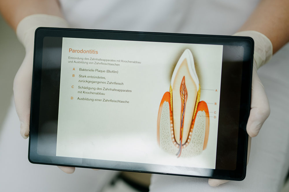 zahnarzt-holzkirchen-paro-v1 zahnarzt-holzkirchen- paro-v1